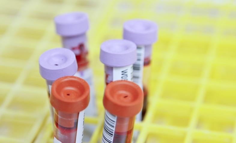 blood test 2