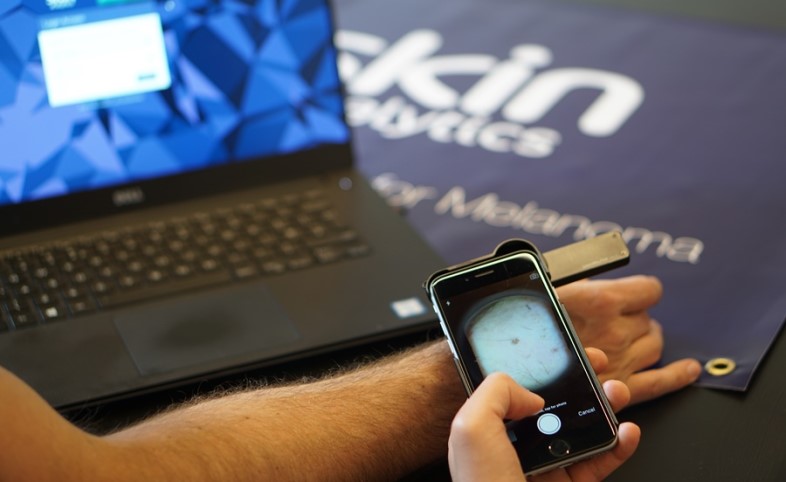 Mobile phone using Skin Analytics to assess a skin lesion